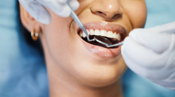 Best Emergency Dental Care for Abscessed Tooth in Buchanan, NY