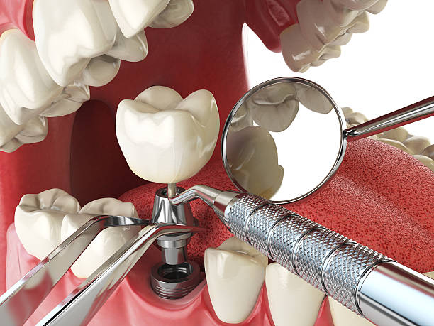 Best Broken or Cracked Tooth Emergency Dentist in Buchanan, NY