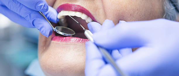 Best Broken or Cracked Tooth Emergency Dentist in Buchanan, NY